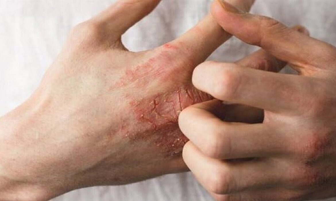 آشنایی با ۶ راهکار مهم برای جلوگیری از خشکی پوست
