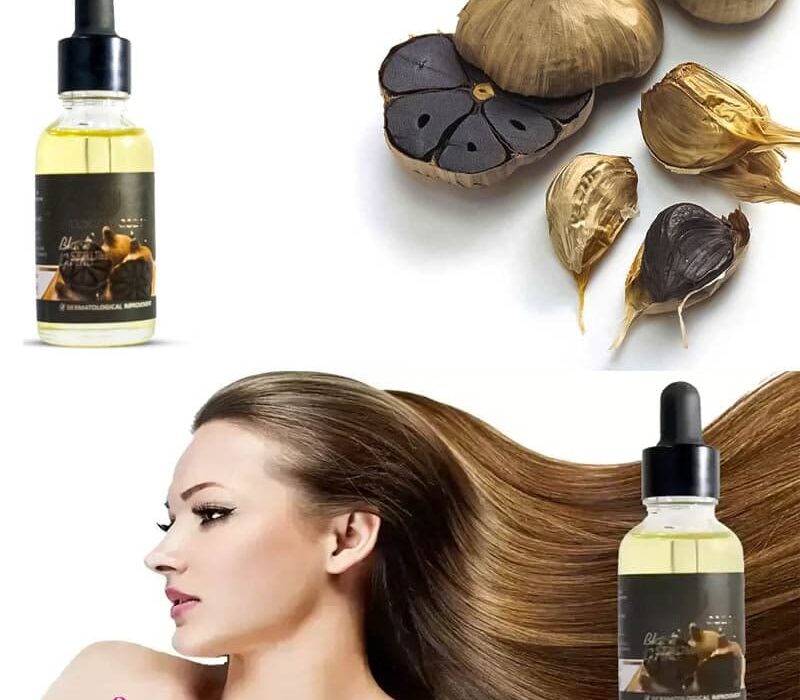 بهترین کرم ضد جوش اورژانسی