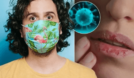 تغییرات عجیب لب‌‌ها بر اثر ابتلا به ویروس کرونا+ تصویر