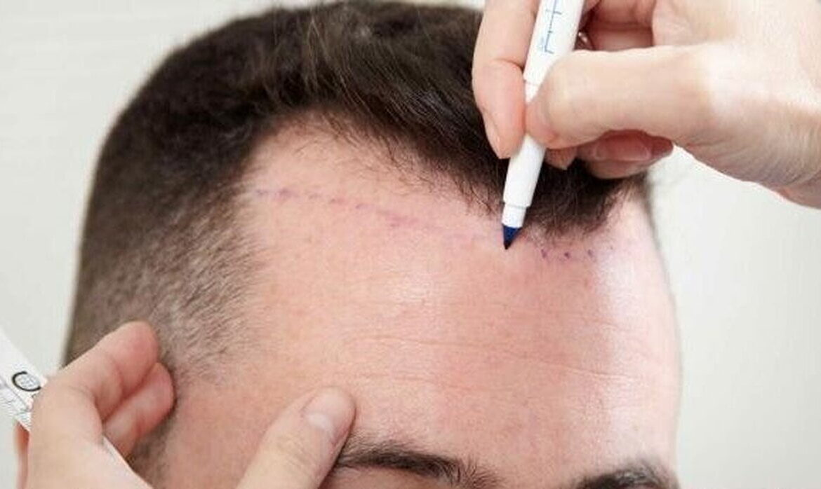دستورالعمل جدید قبل از انجام جراحی‌های زیبایی در استرالیا