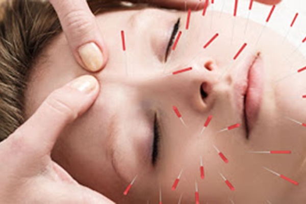 طب سوزنی برای جوان سازی پوست صورت