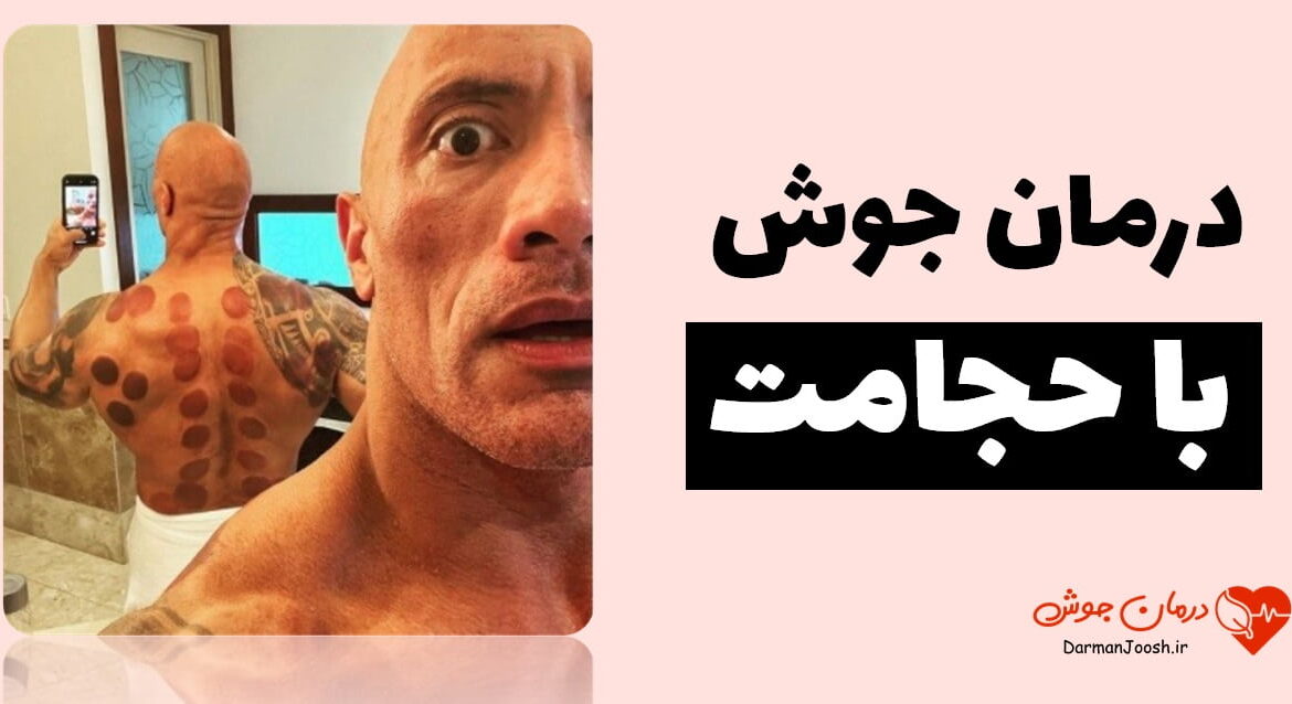 مشکلات کبد و جوش صورت چه ارتباطی باهم دارند؟